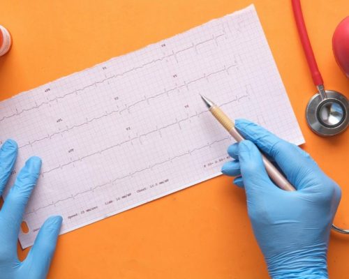 kelainan listrik jantung