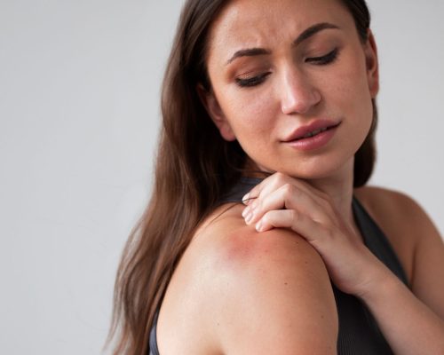 Penyakit Skleroderma