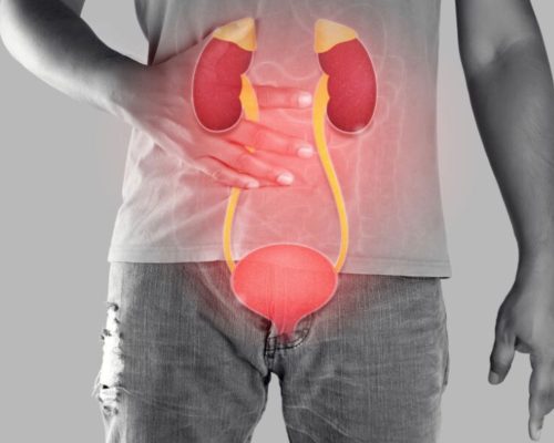 batu saluran kemih