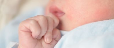 ruam kulit pada bayi