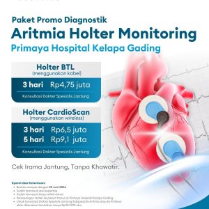 Aritmia Holter Monitoring - Kelapa Gading