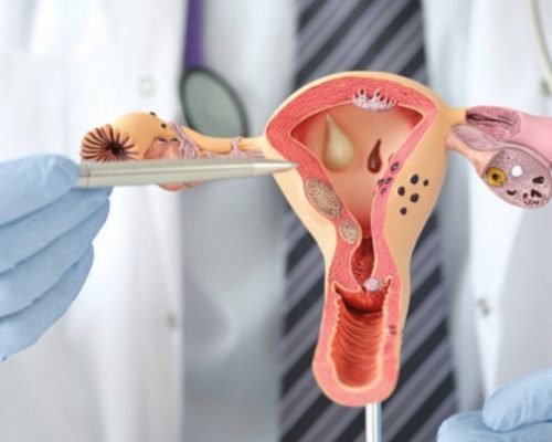 pap smear