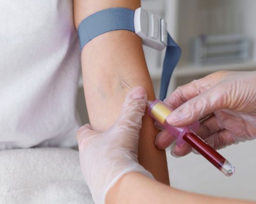 pemeriksaan kolesterol