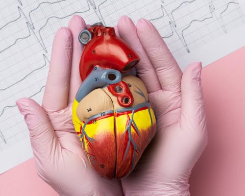 Pemasangan stent jantung