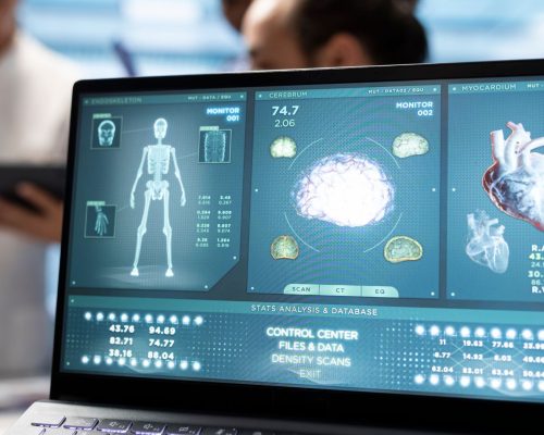 Digital Subtraction Angiography (DSA)