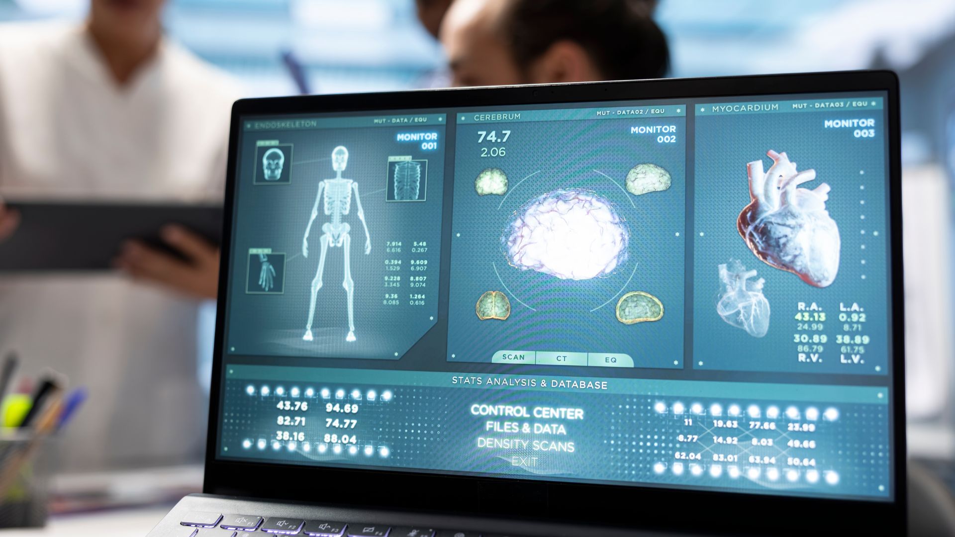 Digital Subtraction Angiography (DSA)