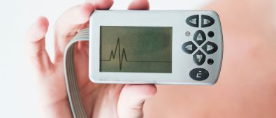 Holter monitoring