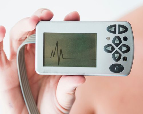 Holter monitoring