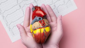 Stent jantung