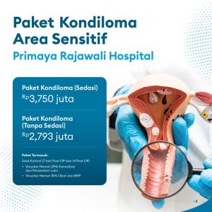 Paket Kondiloma