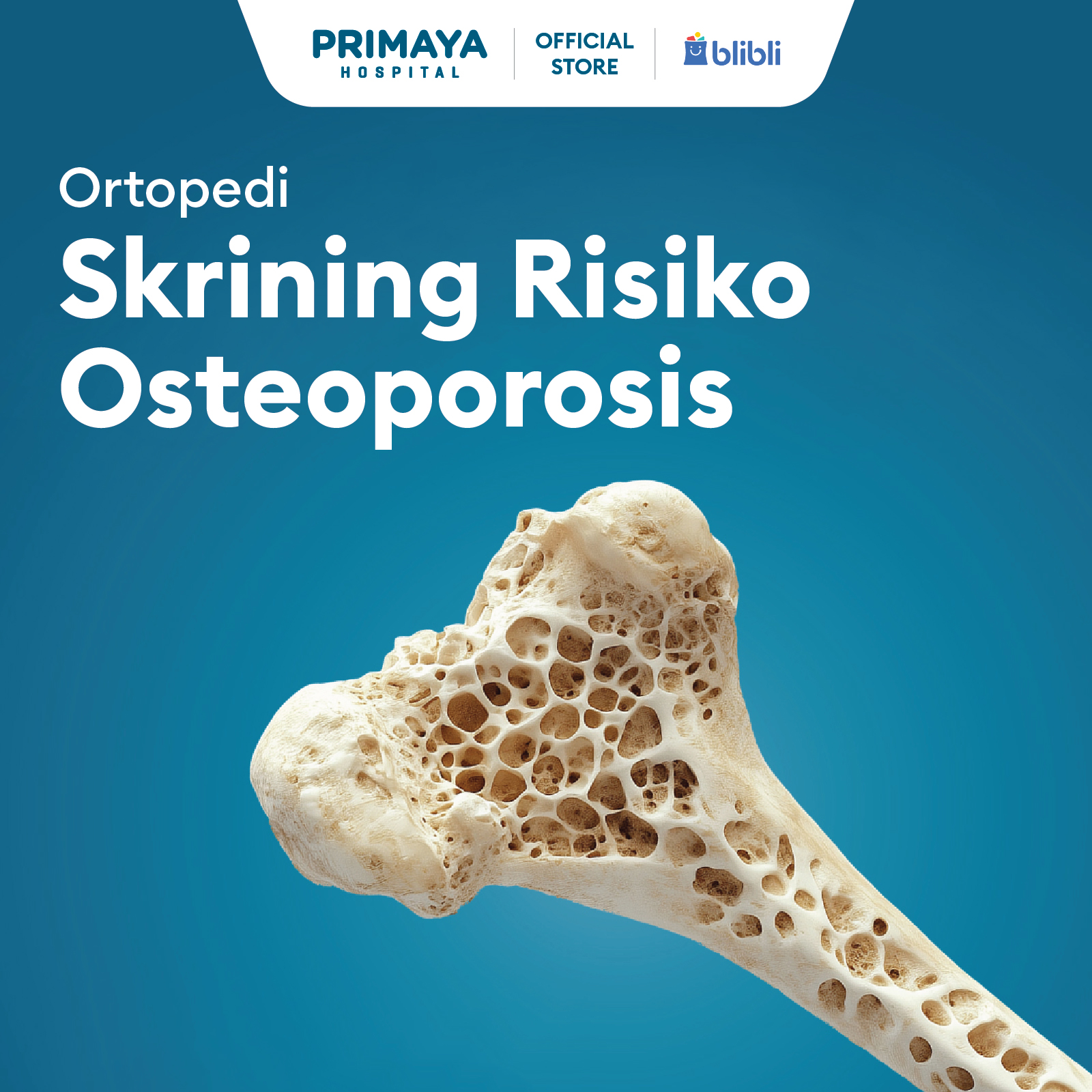 Skrining Risiko Osteoporosis