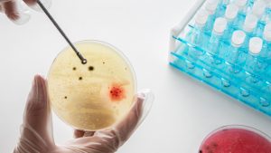 Terapi Stem Cell
